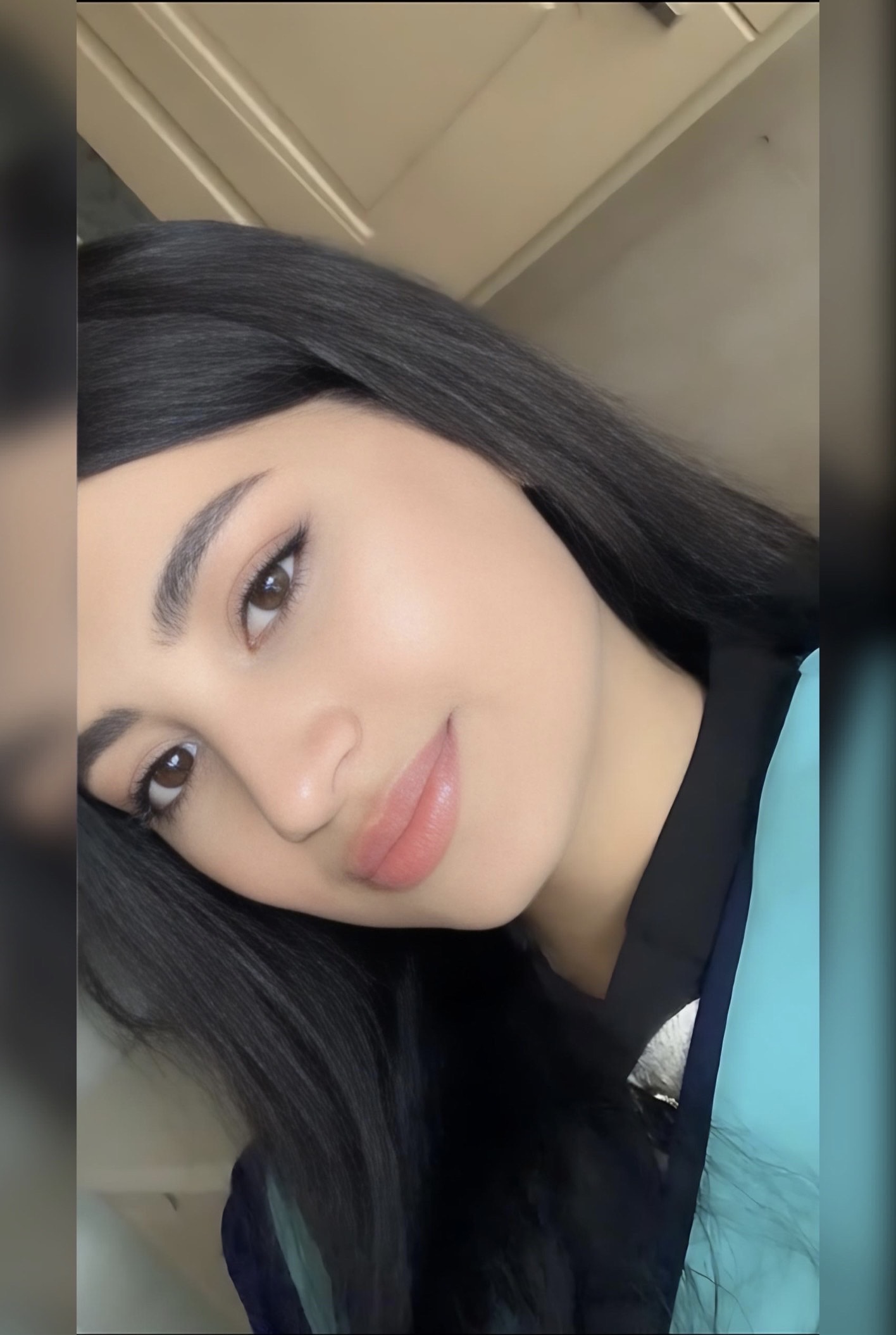 تەکنیککاری لەیزەر